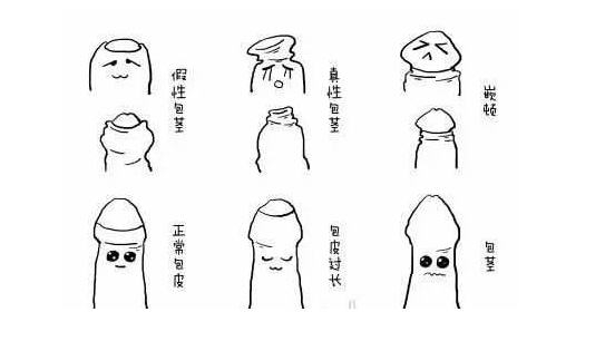 割包茎水肿多久能好(隐茎手术拆环后水肿多久能好）