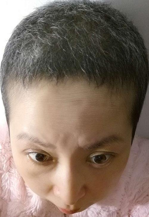 化疗后多久可以怀孕(化疗后的白发能染吗）