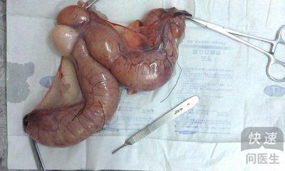 别推脱！＂折腾＂女性子宫的4件事,有3件都跟男性扯上关系！(子宫囊肿）