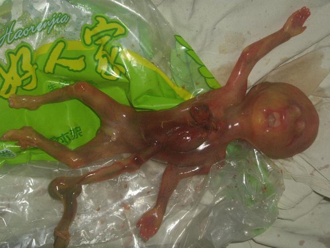 吃酵素真的有利于怀孕吗？小心食物中毒！(备孕能吃酵素吗）