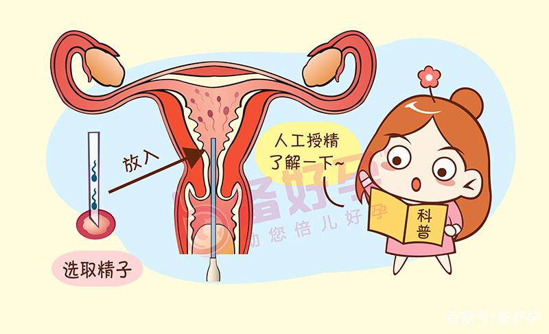 人工授精适合什么人群(什么样的人需要做人工授精)