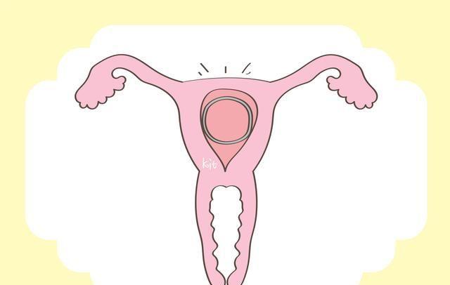 什么人不适合带避孕环(什么样的人适合戴避孕环）