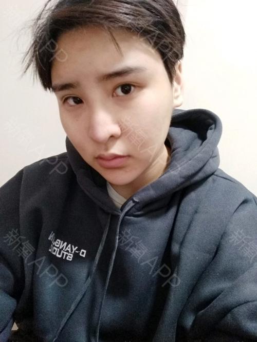 卵泡好几天不长正常吗(一侧卵巢只有一个卵泡正常吗）