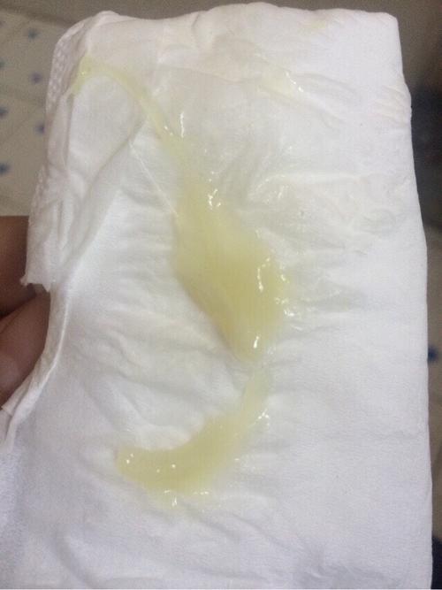 吃了避孕药的第三个月会怎么样(短效避孕药第三个月怎么吃）