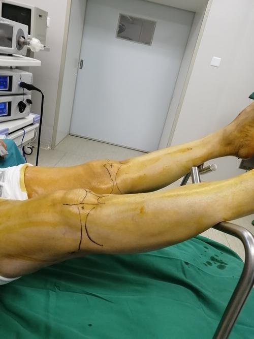 什么瑜伽动作对乳房好6个瑜伽动作让你远离乳房疾病！(瑜伽乳腺疏通的动作）