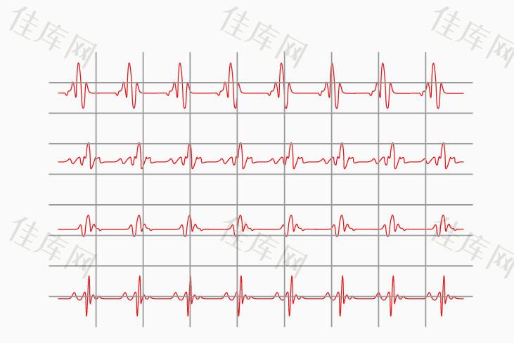 二胎迟迟不怀孕应该做什么检查(孕检都检查什么项目）