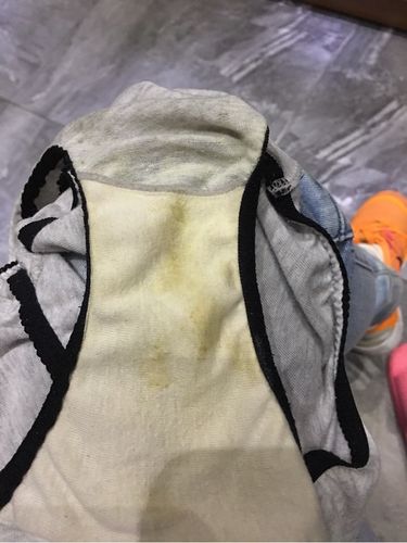 分泌物像水一样无味,正常吗(白带发黄内裤上干了像一层壳)