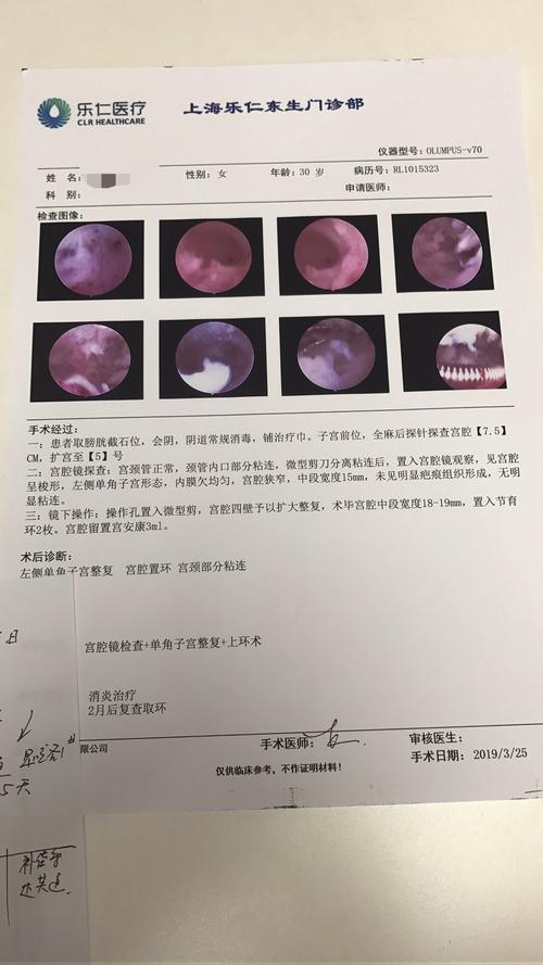 做宫腔镜手术多少钱(做腹腔镜手术后多久可以怀孕）