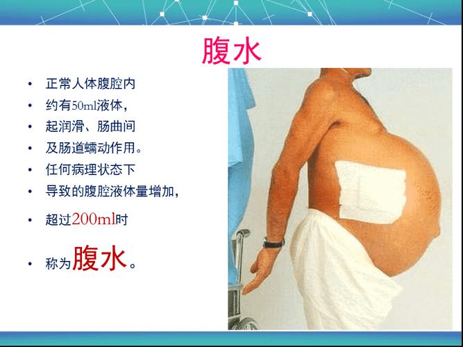 取卵后腹水的人多吗(取卵后人特别容易累）