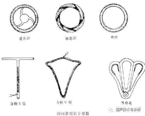 节育环下移的诊断标准(环下移b超诊断标准）