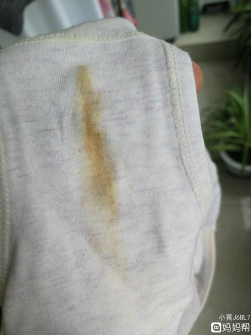 分泌物有腥臭味是什么原因引起的(豆腐渣状分泌物图片）