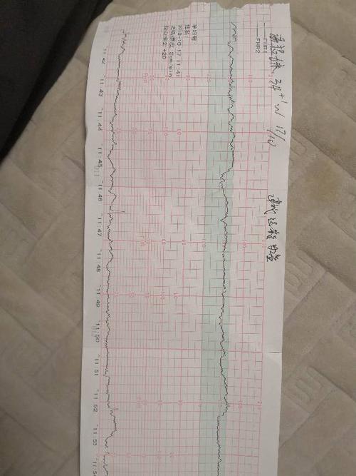 同房后两个月孕囊多大(孕囊多大mm时有卵黄囊)