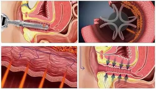 同房不科学引发不孕，有哪些需要特别注意？(夫妻两人都没问题为什么就是怀不上）