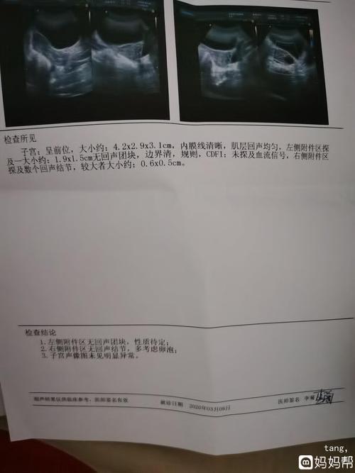 卵泡1(卵泡19x17当天会破吗）