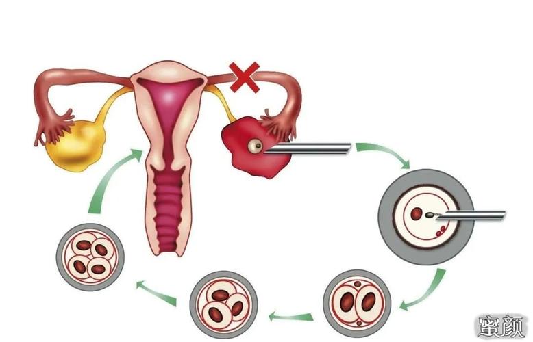 促排卵药有哪些(最安全的促排卵药）