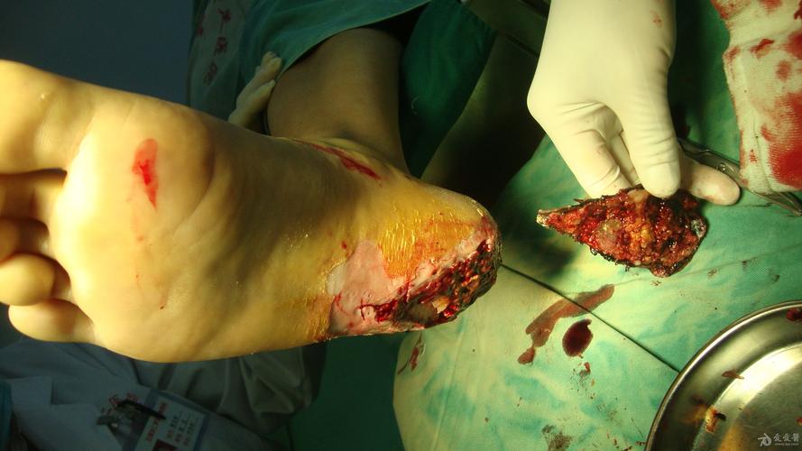 取卵对女性的伤害大吗女性朋友们一定要看！(多次取卵对身体的伤害）