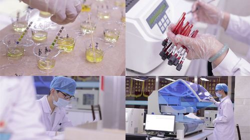 前列腺液检查正常标准报告单一分钟教你看懂报告单(怎样看懂性激素报告单）