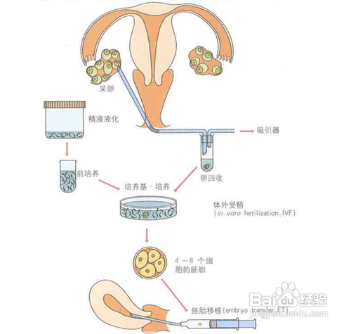 人工授精多少钱一次没有想象的昂贵(人工授精贵不贵）