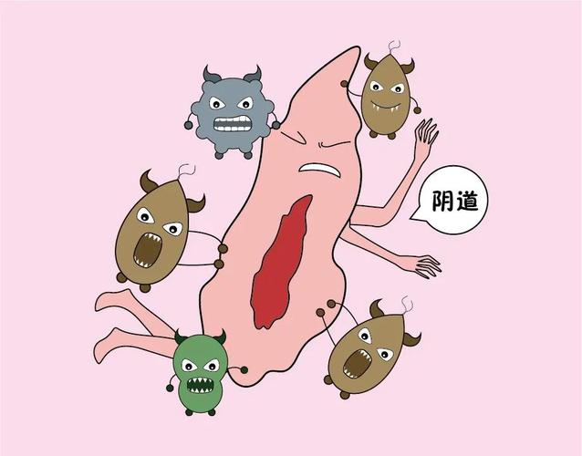 分泌物像豆腐渣是怎么回事(下面很痒还有像豆腐渣什么原因)