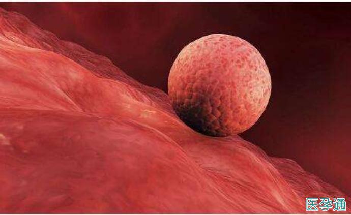 受精卵着床失败原因有哪些？(怀孕着床有什么症状）