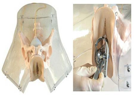 刮了宫以后会怀孕吗(刮宫了还能生孩子吗）