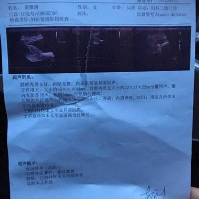 同房受孕50天孕囊多大(实际同房30天,孕囊多大）