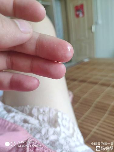 产后45天同房会怀孕吗(怀孕初期下面有什么变化）