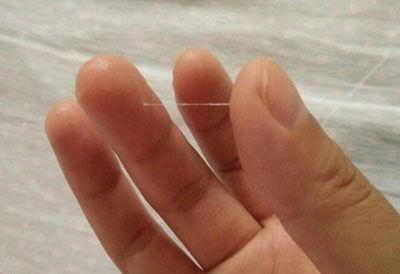 分泌物有酸味什么原因(白带有股醋一样的酸味正常吗)