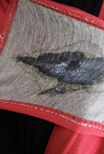 分泌物有酸味什么原因(白带有股醋一样的酸味正常吗)