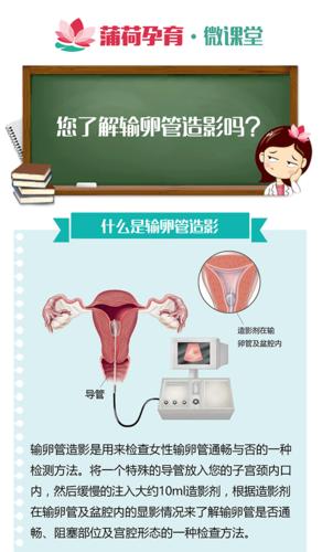 输卵管造影检查痛苦吗(正常输卵管造影图）