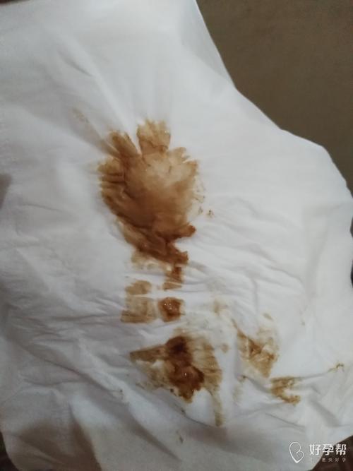 非经期少量出血咖啡色一样吗(月经8至10天还有咖啡色）