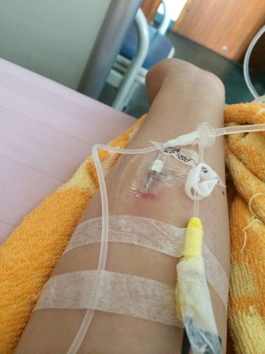 输液多久后可以怀孕(输液抗生素多久可以要孩子)