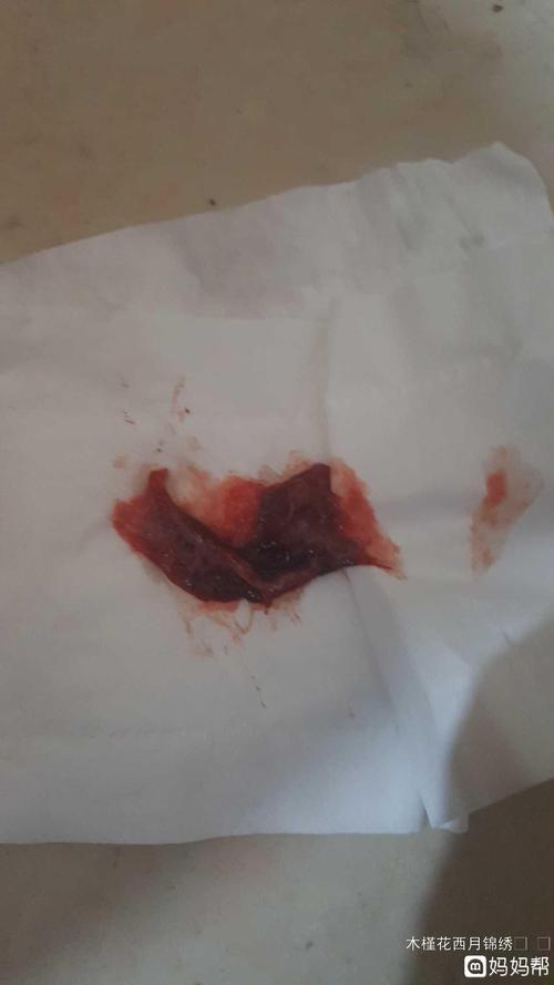 自然流产为什么没有血(生化妊娠有不流血的吗）