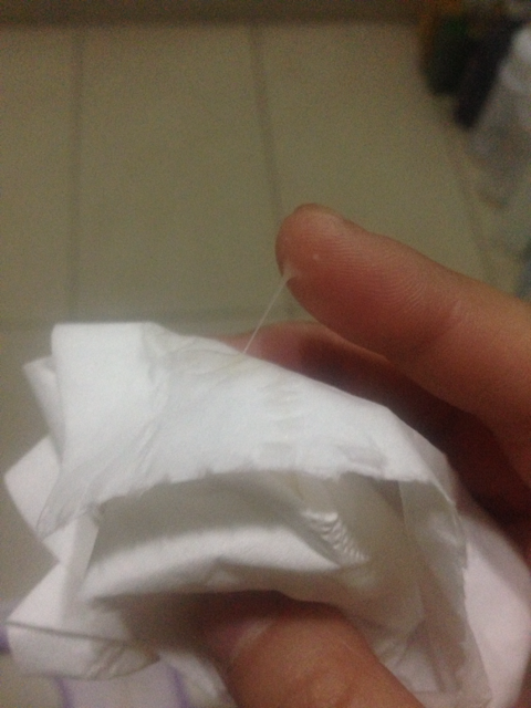 闭经和怀孕的区别(白带什么样说明怀孕了）