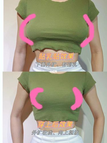 胸外扩下垂怎么改善(如何判断胸下垂和外扩）