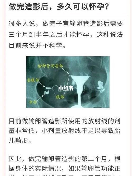 输卵管通水几天能同房(做完输卵管通水后多久可以要孩子）