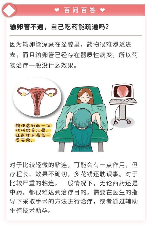 通水可以疏通输卵管吗(输卵管一般要通几次）