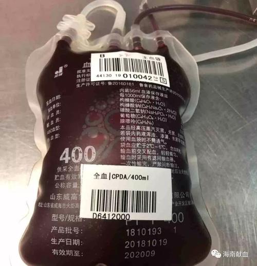 贫血的人可以献血吗(400ml血在医院要多少钱）