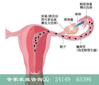 输卵管炎会不孕吗(输卵管摘了对女人有什么影响）