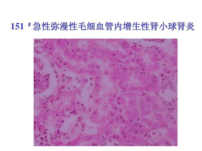 肾盂分离是生男孩吗哪些情况会导致胎儿出现肾盂分离(胎儿发生肾盂分离概率)