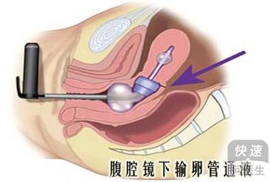 输卵管通水几天能同房(做完输卵管通水后多久可以要孩子）