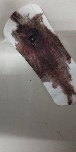 非月经期出血的原因(非经期突然有少量出血）