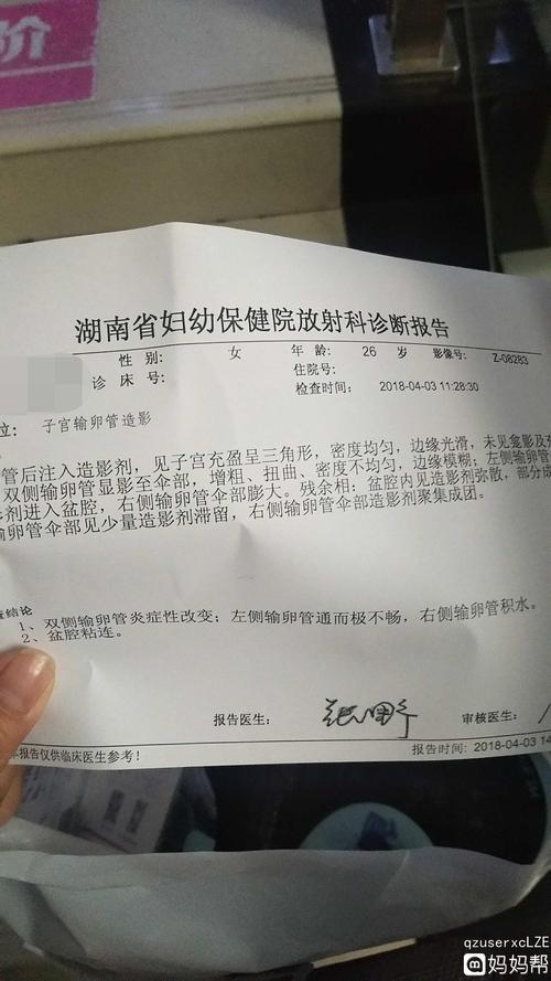 输卵管炎会腹痛吗(输卵管积水跳绳好了）