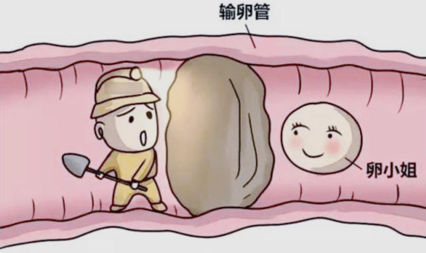 输卵管不通畅会怀孕吗(输卵管堵塞有什么样症状)