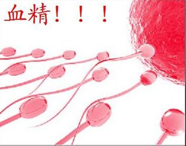 请问血精的怀孕率高吗(血精一般能引起怀孕了)