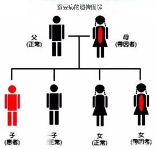 这几种遗传病“重男轻女”，备孕的你要知道(四种传男不传女的遗传病）