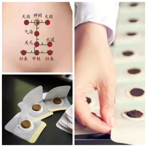 贴三伏贴能吃咸鸭蛋吗(冬至贴三伏贴有效果吗）