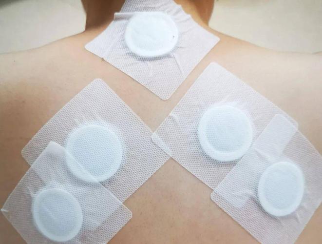 贴三伏贴后很痒怎么办(贴了三伏贴后皮肤红肿瘙痒怎么办）