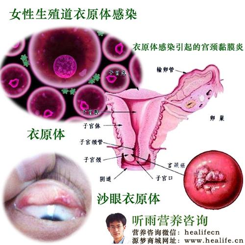 衣原体支原体不孕不育什么关系(女性有衣原体一般什么原因造成）