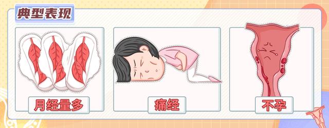 非经期肚子疼是怎么回事？小心易导致不孕的疾病(不是经期小腹坠痛出血）